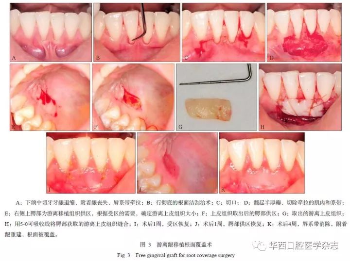 牙齒再生技術(shù)最新進(jìn)展，重塑口腔健康的未來(lái)之夢(mèng)